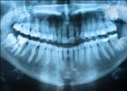 Mercado de rayos X dentales