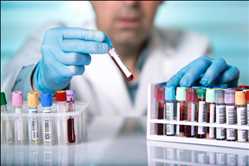 Mercado mundial de pruebas de oncología hematológica