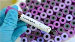 Mercado mundial de diagnóstico de coronavirus