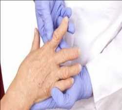 Mercado mundial de medicamentos para la artritis reumatoide