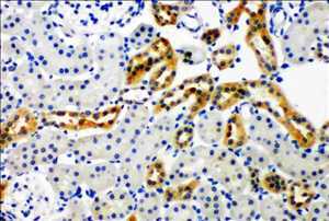 Demanda del mercado mundial de NADPH oxidasa 4