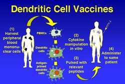 Pronóstico del mercado mundial de vacunas contra el cáncer de células dendríticas