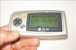 Perspectiva global del mercado de equipos de ECG de un solo cable