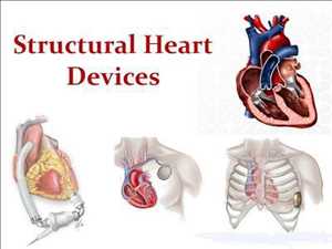 Crecimiento del mercado mundial de dispositivos cardíacos estructurales
