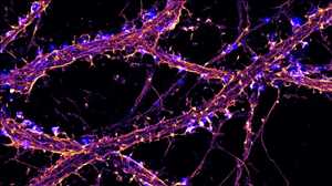 Pronóstico del mercado mundial de microscopios de súper resolución